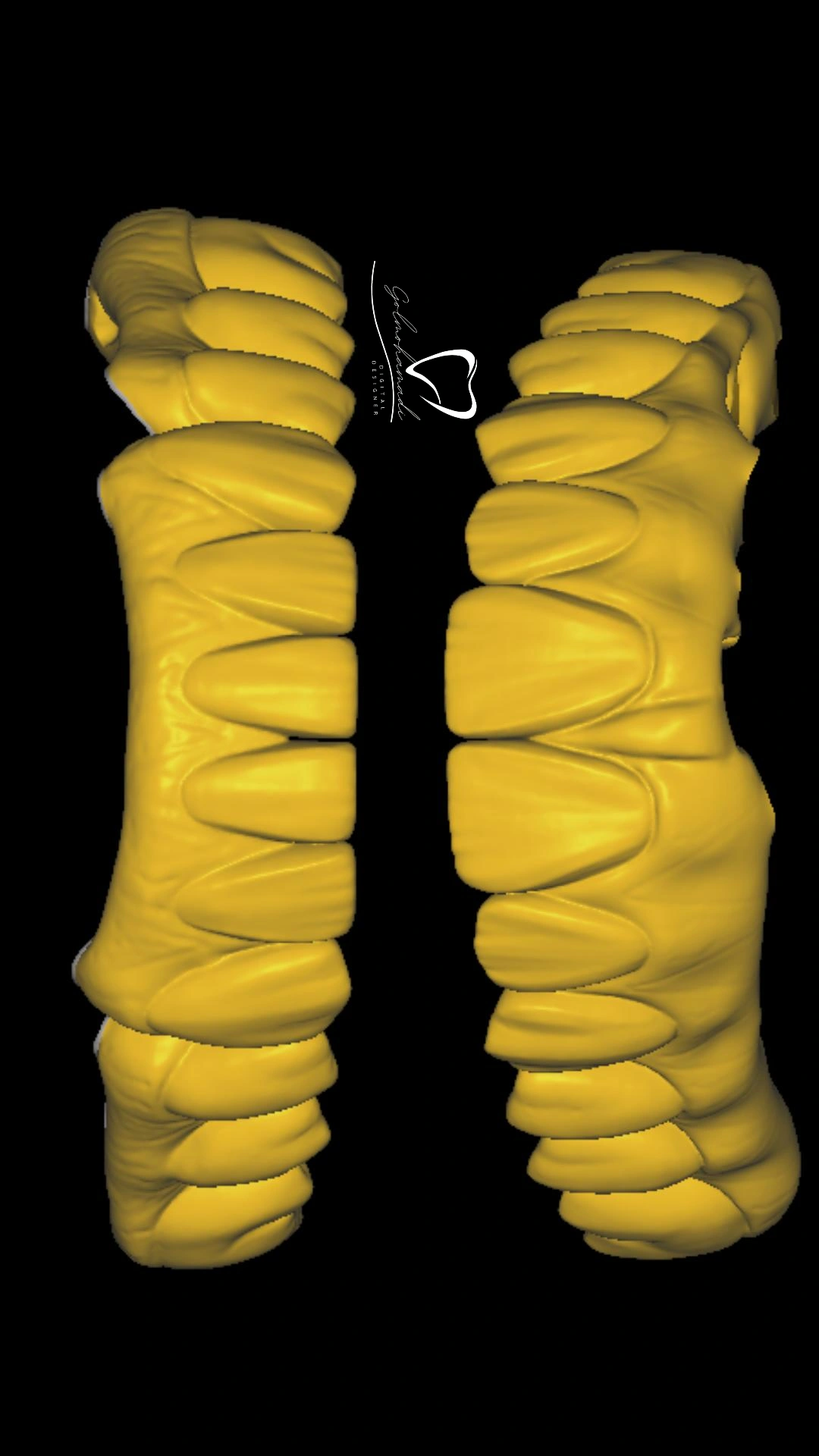 نرم‌افزار Exocad چیست؟ آموزش طراحی دیجیتال دندان‌سازی با Exocad